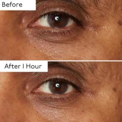 By Terry Hyaluronic Global Eye Serum -Care Product Store By Terry Hyaluronic Global Eye Serum Before After 2