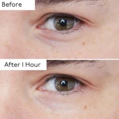 By Terry Hyaluronic Global Eye Serum -Care Product Store By Terry Hyaluronic Global Eye Serum Before After