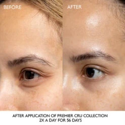 Caudalie Premier Cru The Eye Cream 7 Caudalie Premier Cru The Eye Cream -Care Product Store Caudalie Premier Cru Dark Circle Correcting Eye Cream Before After