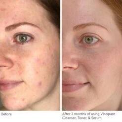 Caudalie Vinopure Purifying Gel Cleanser -Care Product Store Caudalie Vinopure Purifying Gel Cleanser 3