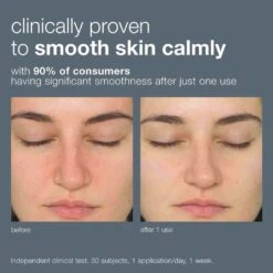 Dermalogica Daily Milkfoliant -Care Product Store Dermalogica Daily Milkfoliant Before After