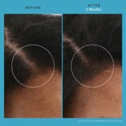 Living Proof Scalp Care Revitalizing Treatment -Care Product Store LivingProof ScalpCare Revitalizing Treatment Before After d410834a ac6a 49be a485 976644d00528