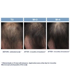 Phyto Phytolium+ Initial Stages Strengthening Treatment -Care Product Store Phyto Phytolium Initial Stages Strengthening Treatment 3