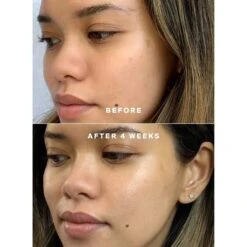 Supergoop! Daily Dose Vitamin C + SPF 40 Serum -Care Product Store Supergoop Daily Dose Vitamin C SPF 40 Serum Before After