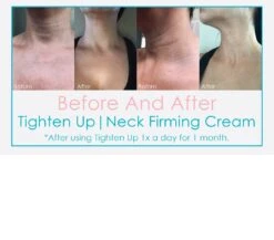 Epicuren Tighten Up Neck Firming Cream 5 Epicuren Tighten Up Neck Firming Cream -Care Product Store TIGHTEN UP BEFORE AFTER 1800X2048 1400x 1a0cd3c7 8b85 4b39 8c18 f1a08b6e58c3